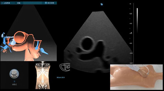 超聲模擬實訓系統(tǒng) 單機版（女）